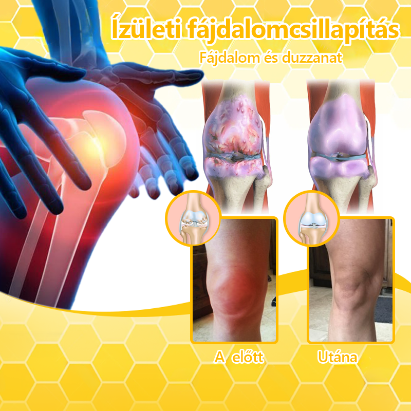 ✅Hivatalos üzlet: 𝐋𝐎𝐕𝐈𝐋𝐃𝐒™ Méhméreg fájdalomcsillapító csontgyógyító krém 👨⚕️Magyar Csontgyógyászok Egyesülete (EMA) jóváhagyásával (csökkenti az ízületi duzzanatot, fájdalmat, ízületi merevséget, fáradtságot, bőrpírt)