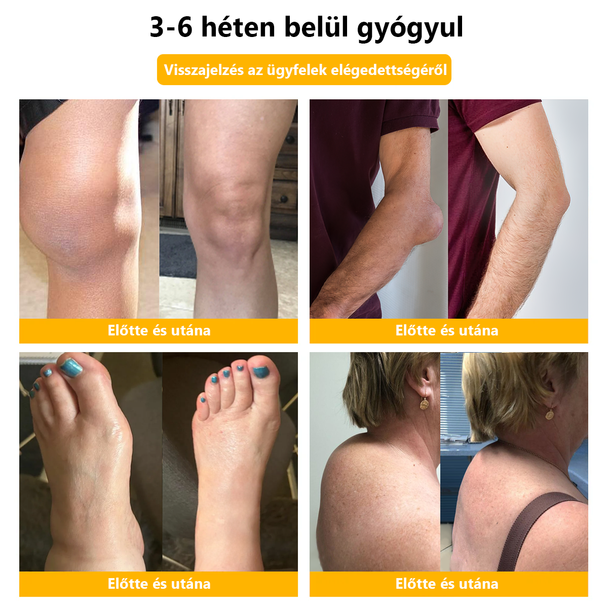 ✅Hivatalos üzlet: 𝐋𝐎𝐕𝐈𝐋𝐃𝐒™ Méhméreg fájdalomcsillapító csontgyógyító krém 👨⚕️Magyar Csontgyógyászok Egyesülete (EMA) jóváhagyásával (csökkenti az ízületi duzzanatot, fájdalmat, ízületi merevséget, fáradtságot, bőrpírt)
