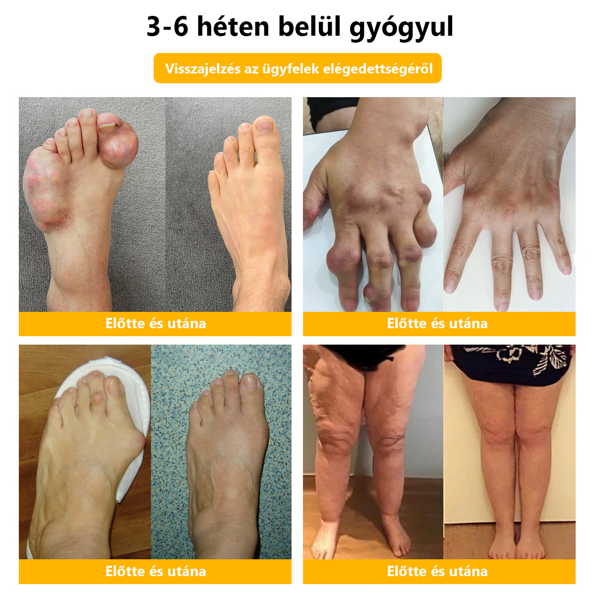 ✅Hivatalos üzlet: 𝐋𝐎𝐕𝐈𝐋𝐃𝐒™ Méhméreg fájdalomcsillapító csontgyógyító krém 👨⚕️Magyar Csontgyógyászok Egyesülete (EMA) jóváhagyásával (csökkenti az ízületi duzzanatot, fájdalmat, ízületi merevséget, fáradtságot, bőrpírt)