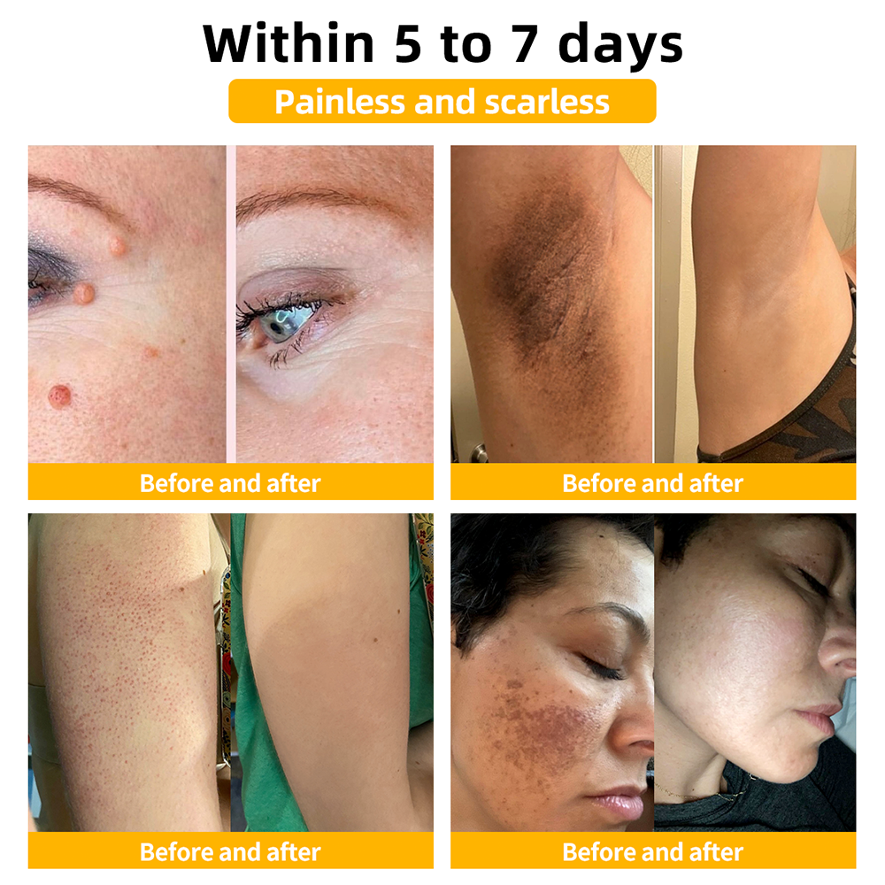 đđąđđđđąâą Bee Venom Skin Treatment CreamïŒEDQM đ
đđđđđđđđđđïŒ