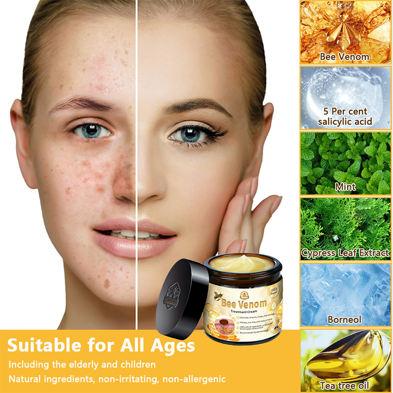 đđąđđđđąâą Bee Venom Skin Treatment CreamïŒEDQM đ
đđđđđđđđđđïŒ