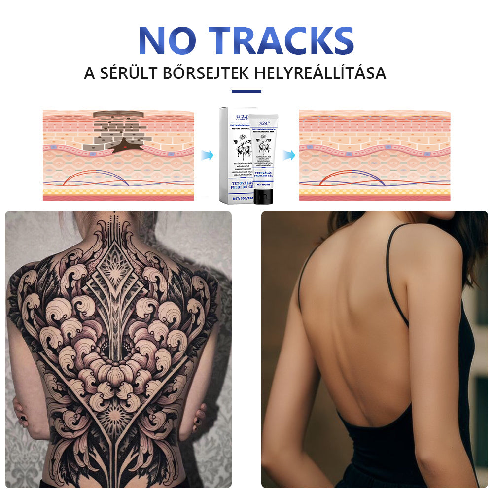 Korlátozott ideig akciós akció - HZA™ Tattoo Dissolving Gel 💝