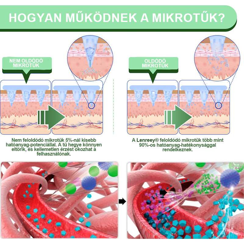 Lenreey® GIP+GLP-1 nano mikrotű tapasz👩⚕️ (Fájdalommentes, hosszan tartó, kezeli a cukorbetegséget, az elhízást és a szív- és érrendszeri betegségeket)✅