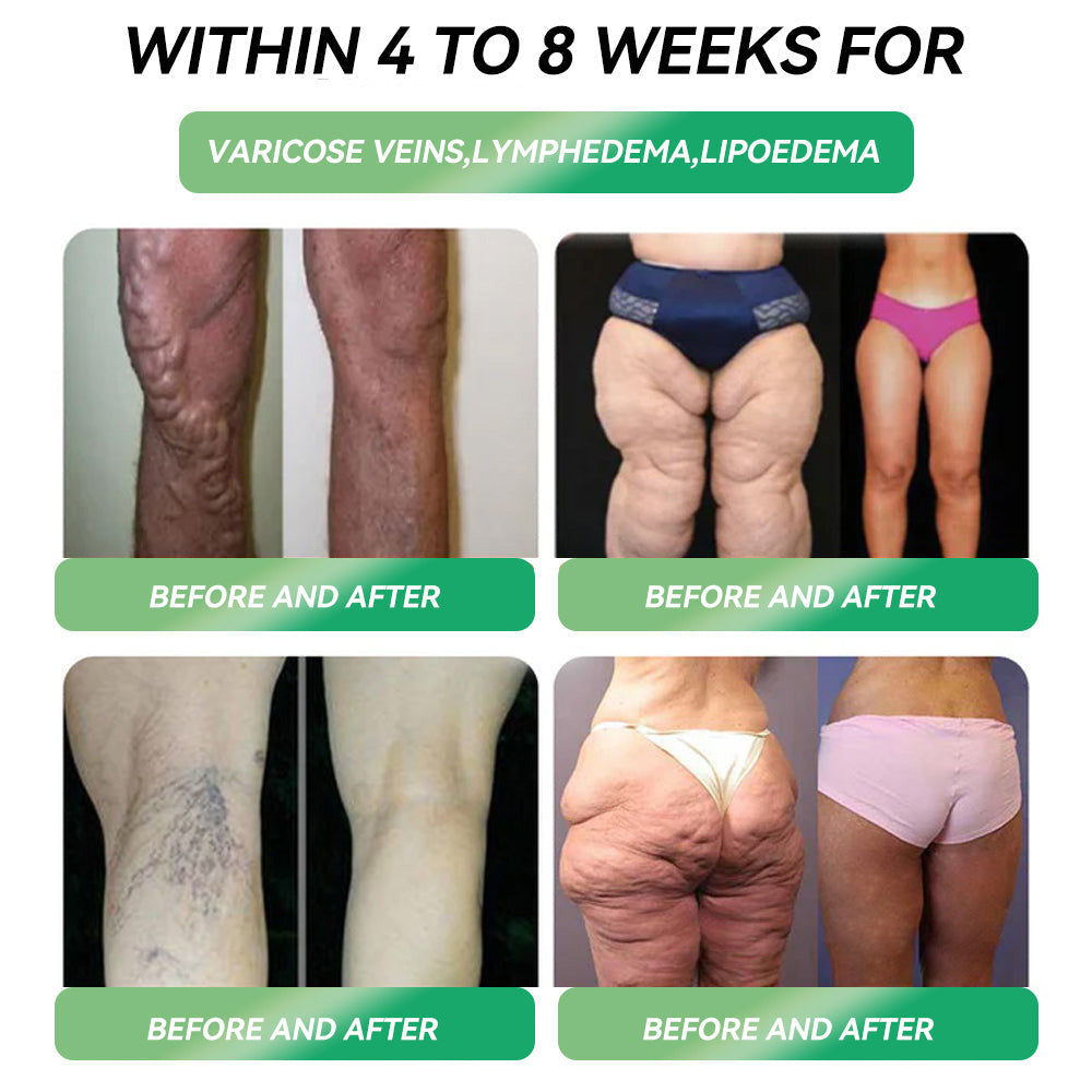 Lotmay® GLP-1& NAD+ Slimming Health Aromatherapy Nasal Stick✅NAD+ Moringa & ACV √ speedy, long-lasting, addressing diabetes, obesity, and cardiovascular diseases)
