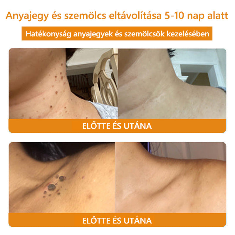 🐝LOVILDS™ TagRecede méhméreg kezelő spray