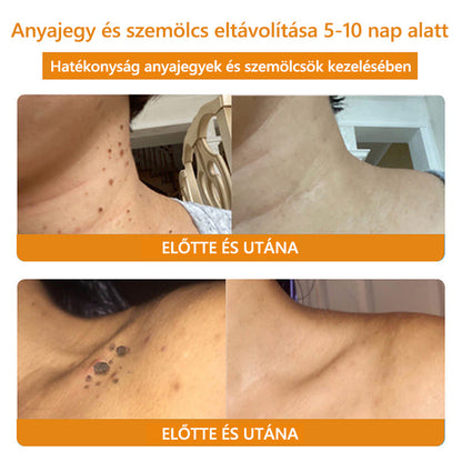 🐝LOVILDS™ TagRecede méhméreg kezelő spray