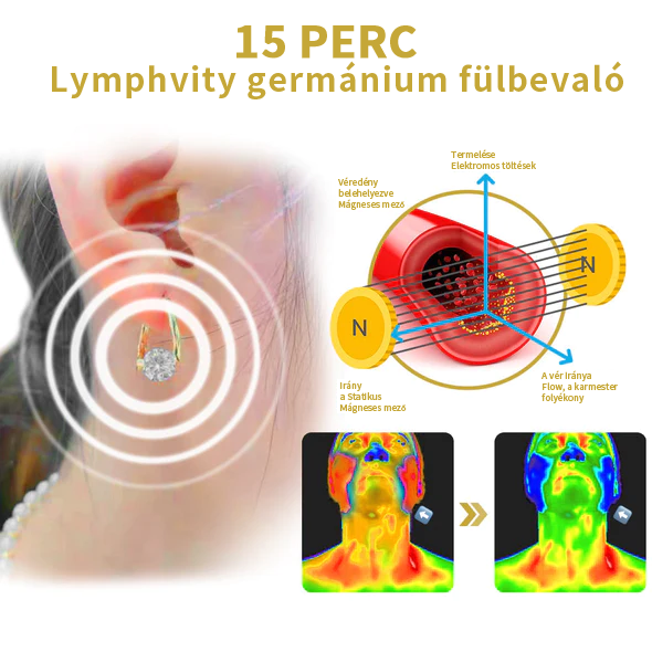 (🔥UTOLSÓ NAP AKCIÓ -80% KEDVEZMÉNY)Histone Lymphvity MagneTerápia Germánium Fülbevaló 💖