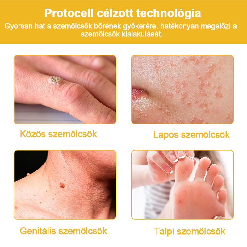 🐝LOVILDS™ TagRecede méhméreg kezelő spray