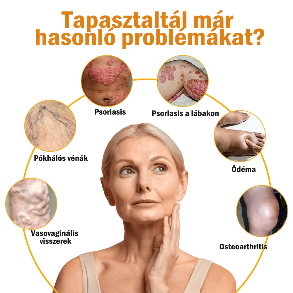 Zoencgz™👨‍⚕️✨Hivatalos márkabolt✨Méhméreg Arthritis & Varicose Vein Treatment Cream (NIPN & HSP Recommends)