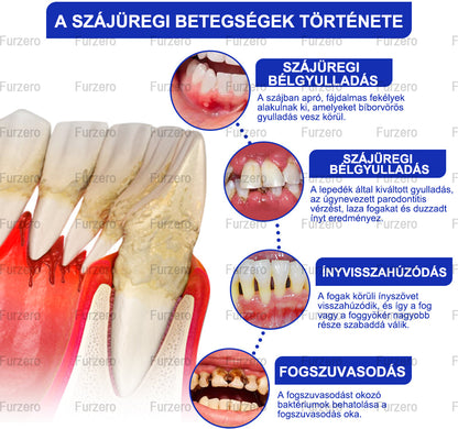 Furzero™ Focussmile Méhméreg Kezelés Szájra Szánt Por 🦷