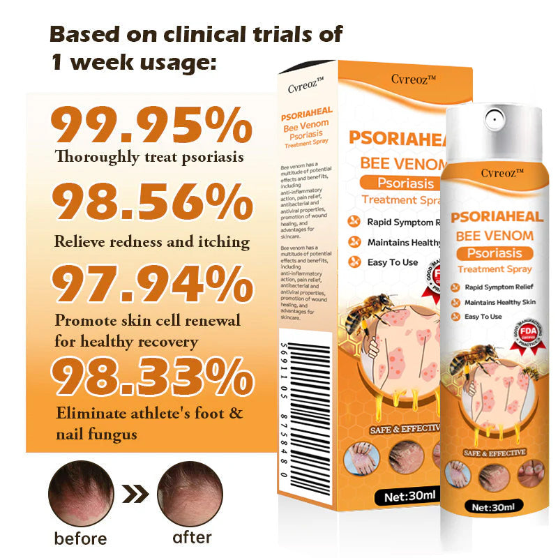 👾Cvreoz™ PsoriaHeal Bee Venom Psoriasis Treatment Spray(Suitable for all skin conditions)