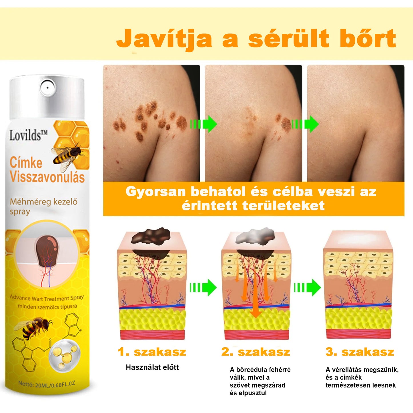 🐝LOVILDS™ TagRecede méhméreg kezelő spray