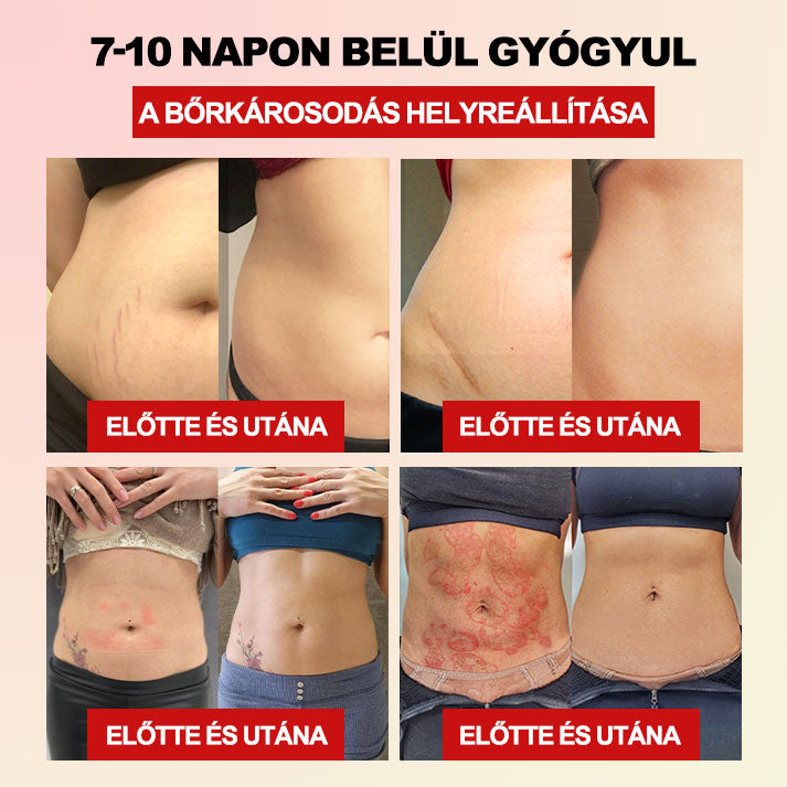 𝐅𝐥𝐨𝐮𝐫𝐢𝐬™ 𝐅𝐢𝐛𝐞𝐫 𝐞́𝐬 𝐖𝐨𝐫𝐦𝐰𝐨𝐨𝐝 𝐚𝐥𝐚𝐤𝐟𝐨𝐫𝐦𝐚́𝐥𝐨́ 𝐝𝐞𝐫𝐞́𝐤𝐯𝐞́𝐝𝐨̋ (𝐏𝐥𝐚𝐬𝐳𝐭𝐢𝐤𝐚𝐢 𝐬𝐞𝐛𝐞́𝐬𝐳𝐞𝐤 𝐚́𝐥𝐭𝐚𝐥 𝐚𝐣𝐚́𝐧𝐥𝐨𝐭𝐭)💏