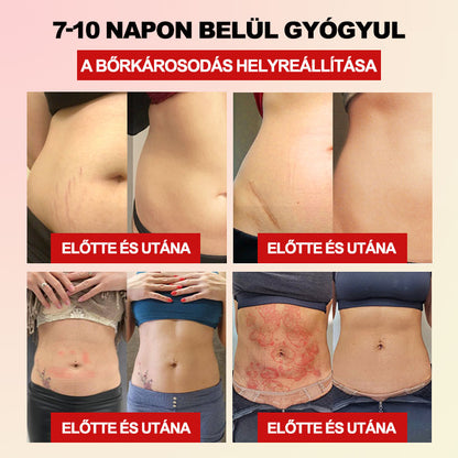 𝐅𝐥𝐨𝐮𝐫𝐢𝐬™ 𝐅𝐢𝐛𝐞𝐫 𝐞́𝐬 𝐖𝐨𝐫𝐦𝐰𝐨𝐨𝐝 𝐚𝐥𝐚𝐤𝐟𝐨𝐫𝐦𝐚́𝐥𝐨́ 𝐝𝐞𝐫𝐞́𝐤𝐯𝐞́𝐝𝐨̋ (𝐏𝐥𝐚𝐬𝐳𝐭𝐢𝐤𝐚𝐢 𝐬𝐞𝐛𝐞́𝐬𝐳𝐞𝐤 𝐚́𝐥𝐭𝐚𝐥 𝐚𝐣𝐚́𝐧𝐥𝐨𝐭𝐭)💏