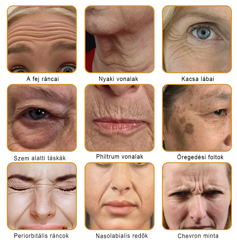 🐝PUROSA® Méhméreg Bőrmegújító Krém｜Teljes körű megoldás a makacs bőrproblémák, például az öregedés, ekcéma, hegek és pikkelysömör ellen